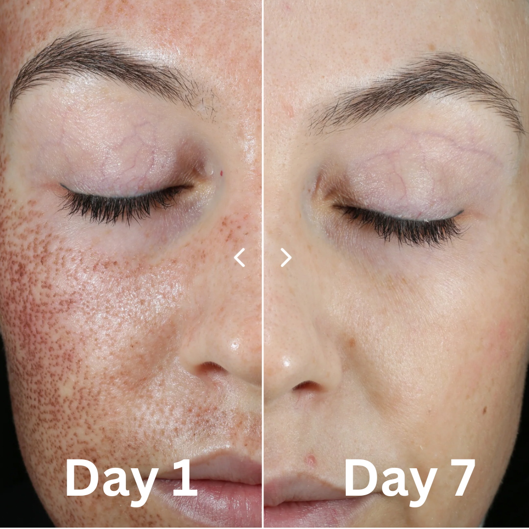 CALM SERUM