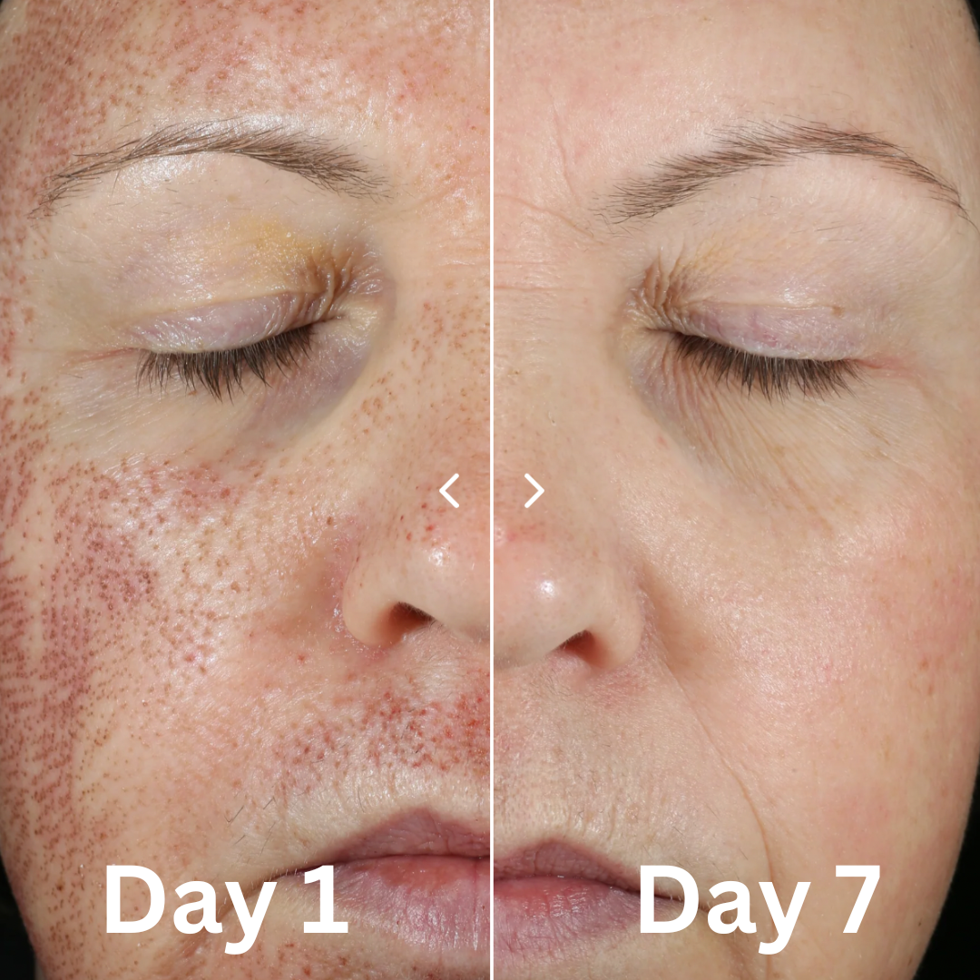 CALM SERUM
