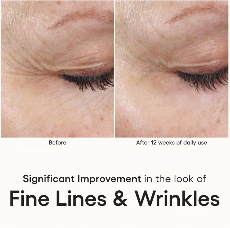 INTENSE SERUM