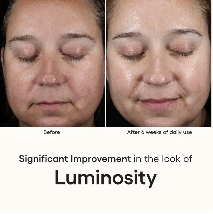 INTENSE SERUM